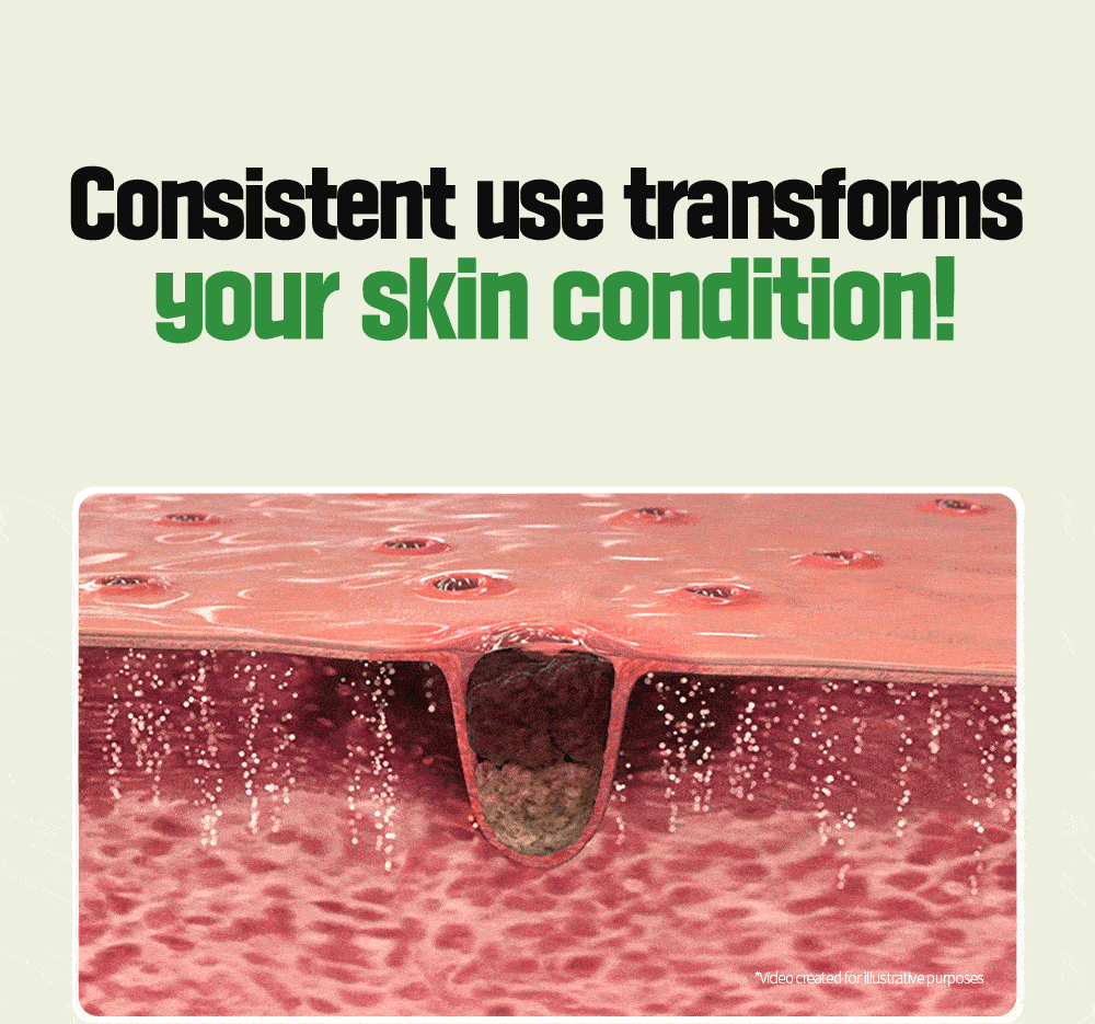 Calming Madecasoside Spot Cream