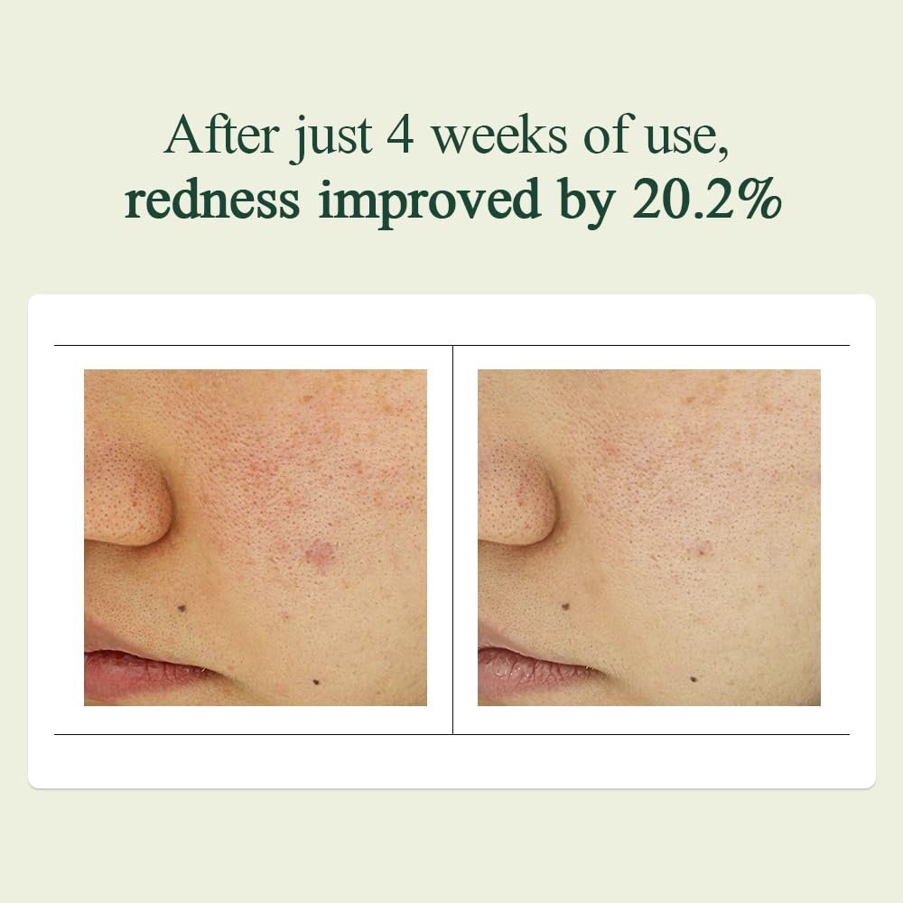 Calming Madecasoside Spot Cream