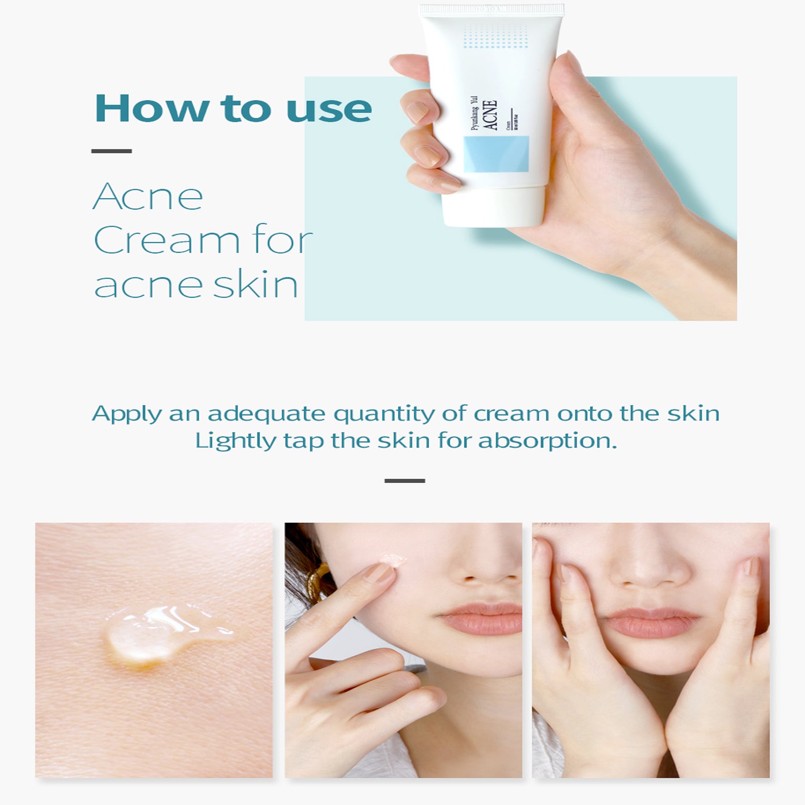 ACNE Cream 50ml