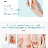 ACNE Spot Cream 15ml